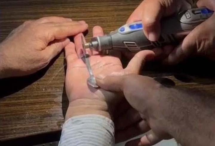Parmaklarına sıkışan yüzükleri itfaiye çıkardı