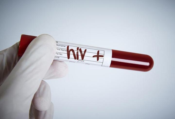 Fiji'de HIV alarmı: Her 60 yetişkinden biri pozitif çıktı! Olağanüstü hal ilan edildi...
