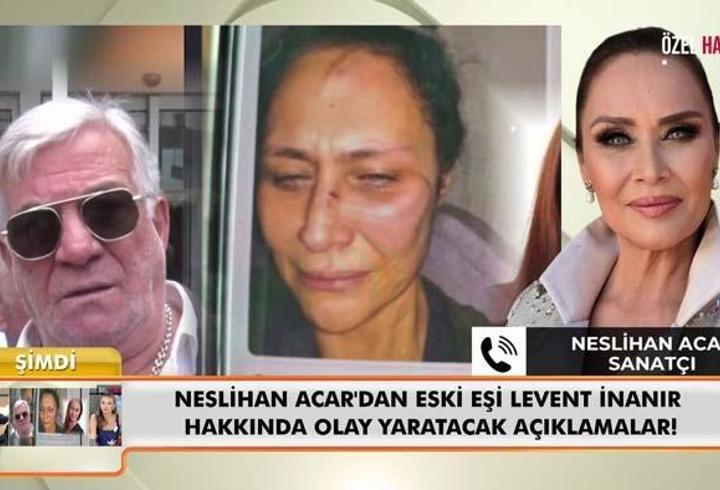 Neslihan Acar'dan 'Neler Oluyor Hayatta' Programına Çarpıcı Açıklamalar: Levent İnanır'dan Şiddet Gördüm! 14 Yıl Sonra Gele O Fotoğraf!