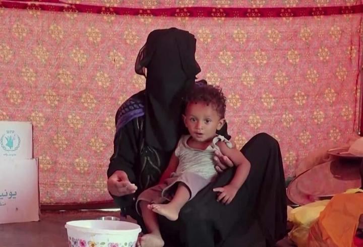 UNICEF'TEN Yemen için kritik uyarı! 2,2 milyon çocuk akut beslenme yetersizliği yaşıyor