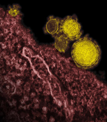 MERS, SARSdan daha ölümcül olabilir