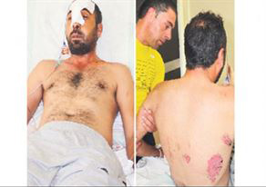 Polis dayağı bu hale getirdi