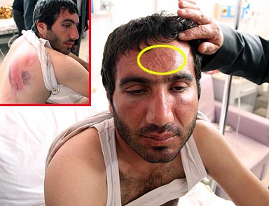 Bismilde öğrenci velisine polisten işkence