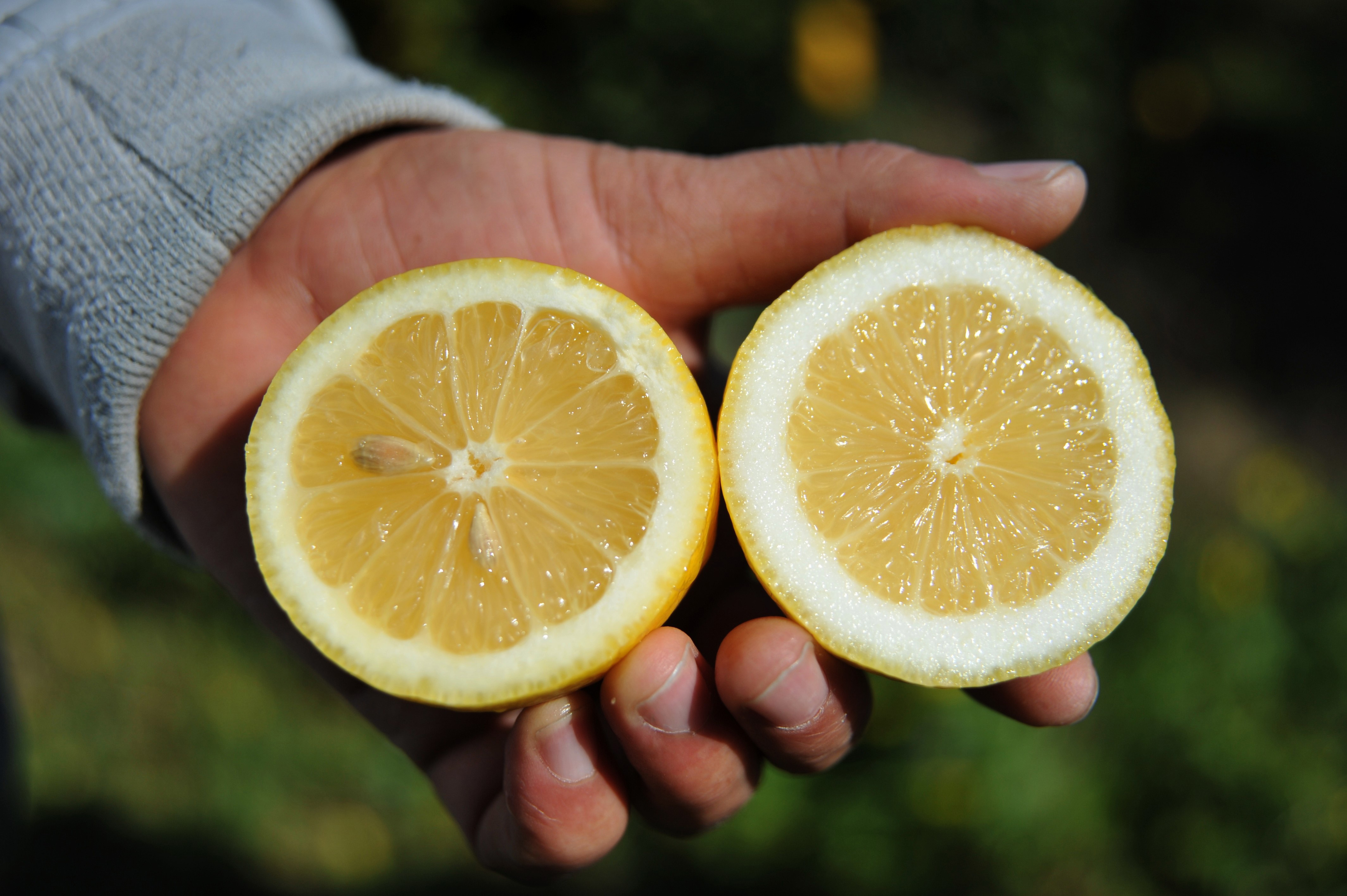 Böbrek taşının ilacı limon