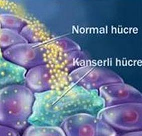 Nefesten kanser teşhisi uzak değil