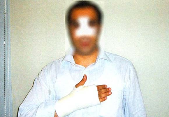 Taksim Karakolunda bir işkence iddiası daha