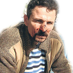 Karakolda dayak yedi, 155i aradı ama...