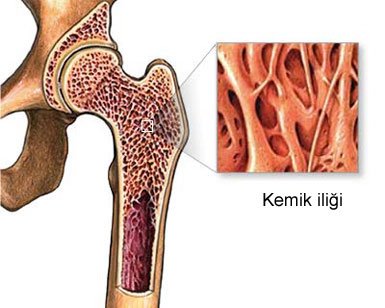 Kemik iliği kanserine dikkat