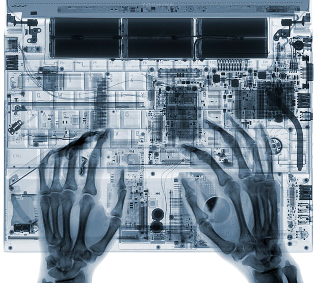 İnsanı hayrete düşüren X-Ray fotoğraflar