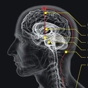 Epilepsi ve Parkinsona çözüm yakın