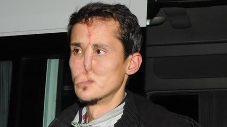 Türkiyenin 7nci yüz nakli gerçekleşti