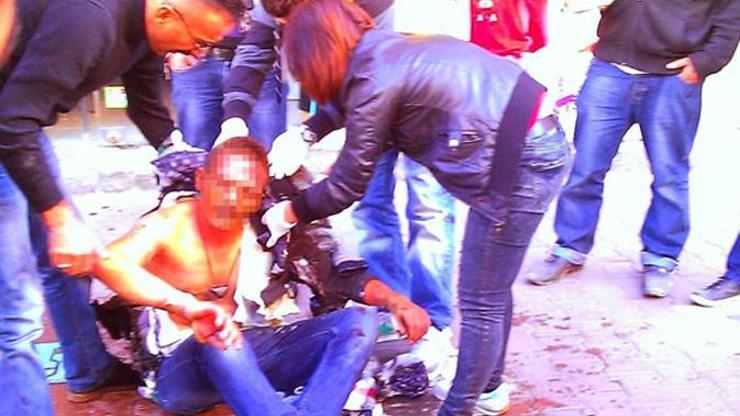Askerden izne geldi, cadde ortasında kendini yaktı