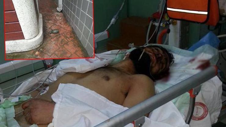 Hastaneye getirilen Suriyelinin üzerinden el bombası çıktı