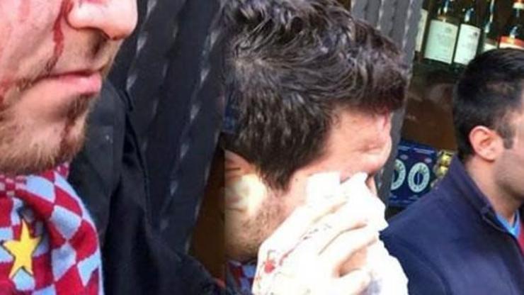 Napoli-Trabzonspor meydan savaşı: 8 yaralı, 2 gözaltı
