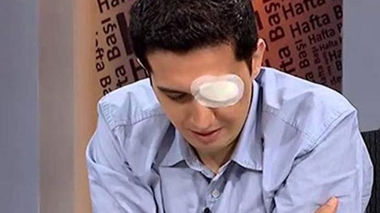 Gezide, akademisyenin gözünü çıkaran fişek böyle atılmış