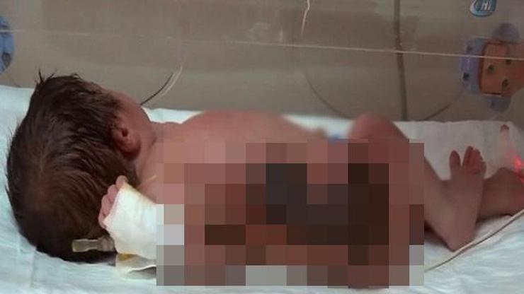 Yeni doğan bebeği ısıtıcıda unutup yaktılar