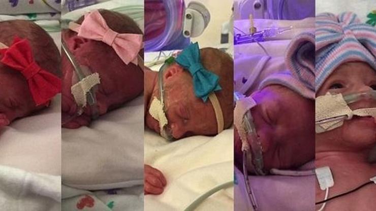 ABD tarihinde ilk beşiz kız bebek