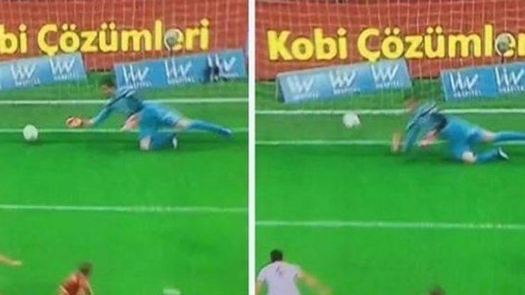 Kolu aniden kısalan kaleci