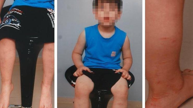 İzmirde 9 yaşındaki çocuk akrabalarından işkence gördü, babası annesini öldürdü