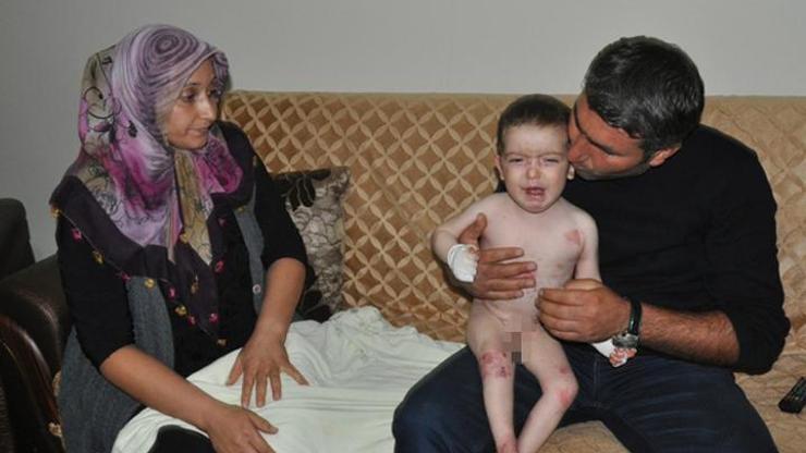 Muhammet Alinin el ve ayakları eriyor