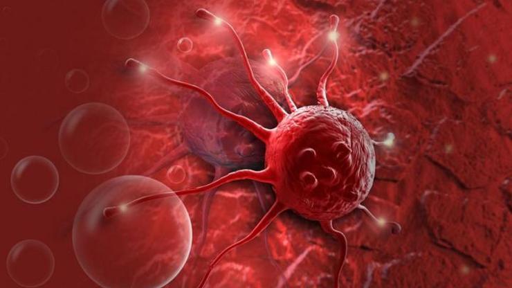 Prostat kanserinin 7 belirtisine dikkat