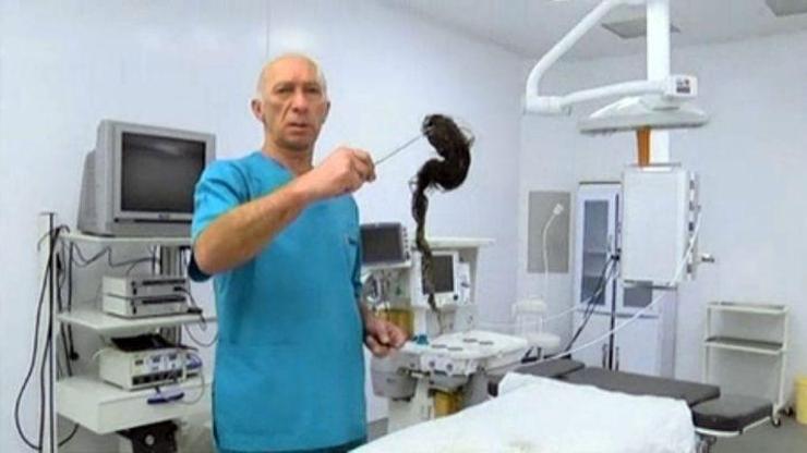 Midesinden 1 kilo saç çıkarıldı