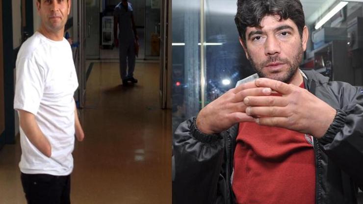 Akdeniz Üniversitesinden çift kol nakli