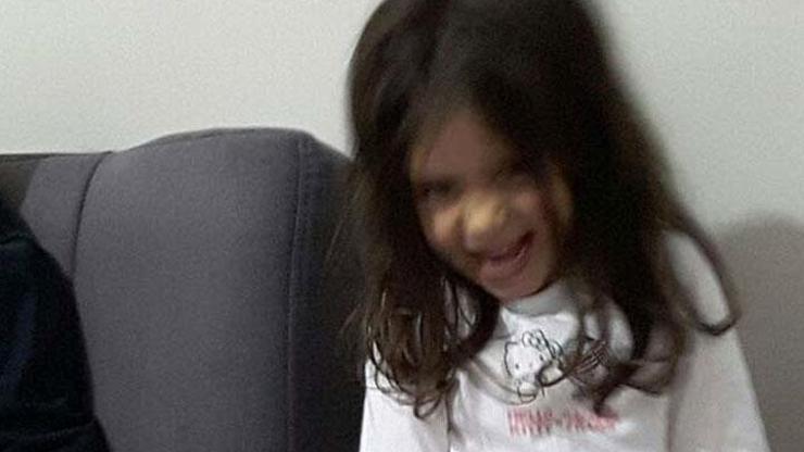 Ankara saldırısının minik mağduru Buse uyandı