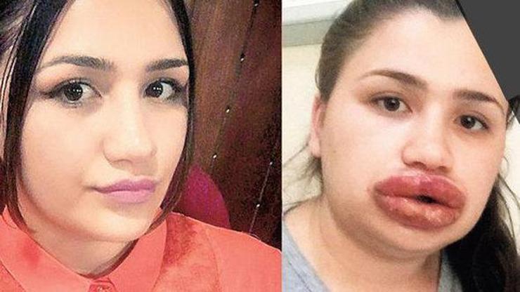Sahte estetikçi kuaföre bir soruşturma daha açıldı