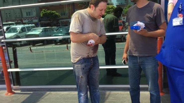 İşçinin hızarda parmakları koptu