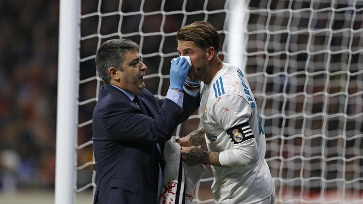 Sergio Ramos 2007de 3 ay kırık burunla oynamıştı