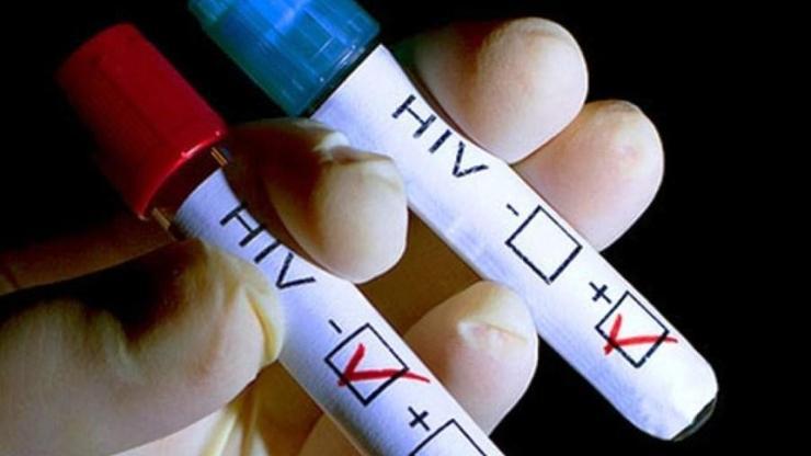 Sahte doktor 21 kişiye AIDS bulaştırdı