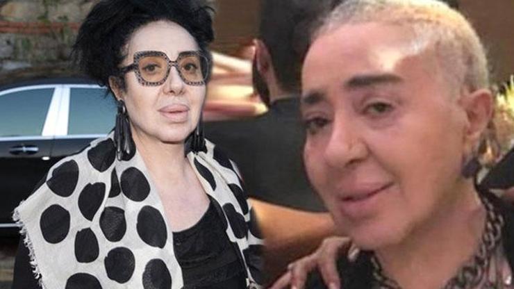 Nur Yerlitaş: “Her gün kemoterapiye gidiyorum”