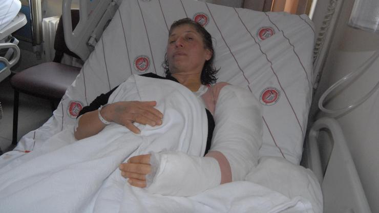 TOMAdan sıkılan tazyikli suyla kırılan kol davası, AİHMe gidecek