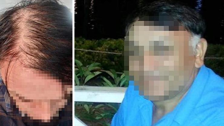 Saç ekiminden memnun kalmayan gıda mühendisi dava açtı