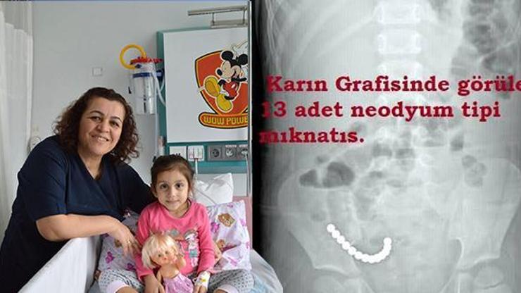 Stres topu mıknatıslarını yutan çocuk ameliyat edildi