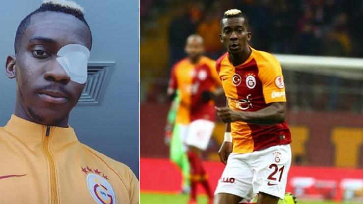 Onyekuru gözünün son halini paylaştı