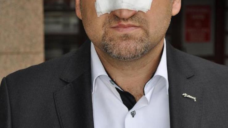 Öğretmenin burnunu kıran belediye başkan yardımcısına başka bir birimde memurluk görevi verildi