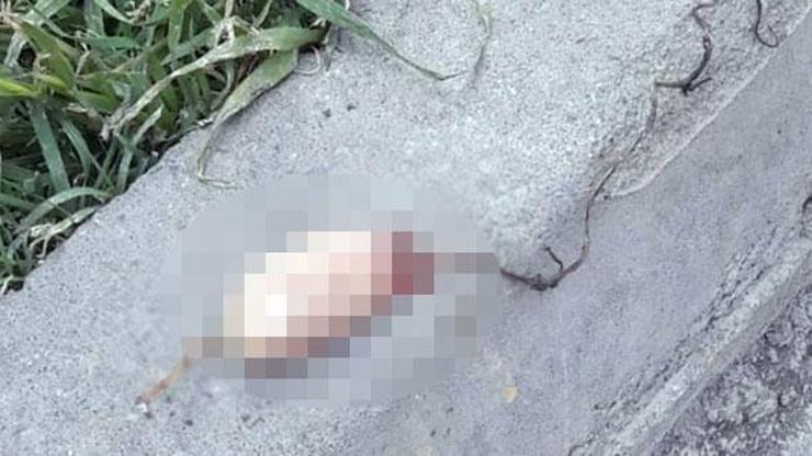 Caddede oyun oynarken kesik parmak buldular