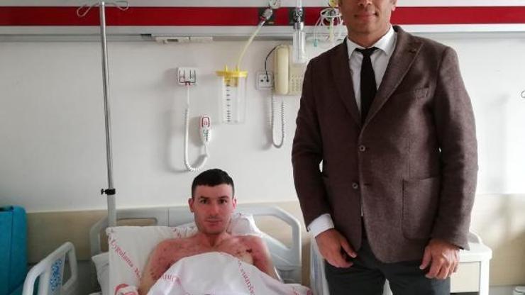 Vücüdunun yüzde 35 yanan genç iyileşti