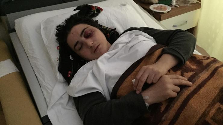 10 yıllık eşi tarafından öldüresiye dövüldü