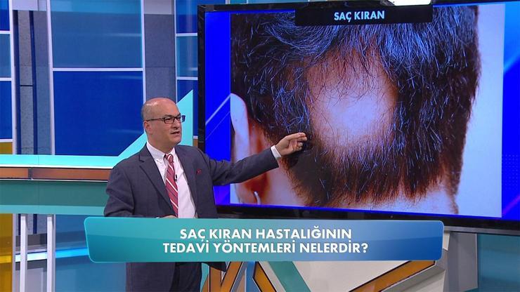 Saç kıran nasıl tedavi edilir
