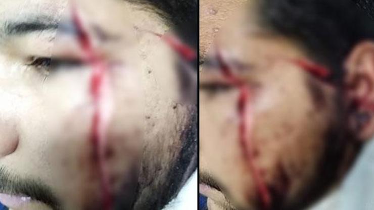 Falçatalı saldırganlar tutuklandı