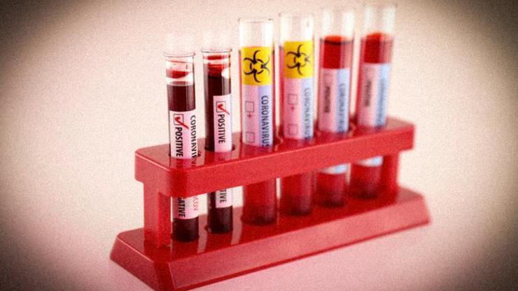 Pandemi nedir DSÖ’nün ‘pandemic’ açıklaması ne demek