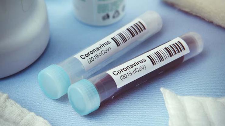 Kanser tedavisi gören kişi koronavirüse yakalanırsa süreç ne olur