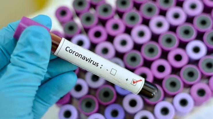 Koronavirüsten korunmada etkili yöntem Ağız Gargarası