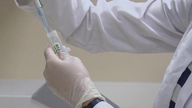 Kovid 19da aşı müjdesi Ankaradan geldi; İnsan denemelerine başlanacak