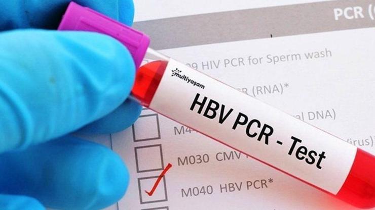 Koronavirüs test fiyatı ne kadar PCR testi ücretleri ne kadar PCR testi fiyat 2020