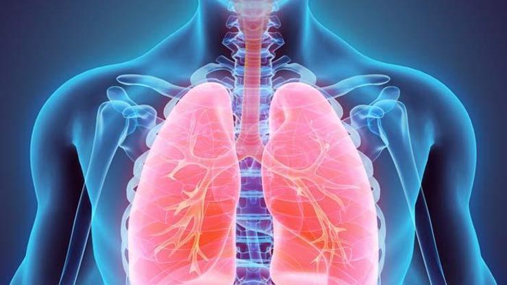 Adenokarsinom Nedir Adenokarsinom Metastazı Ne Demek Akciğer Kanserinin Yaşama Süresi