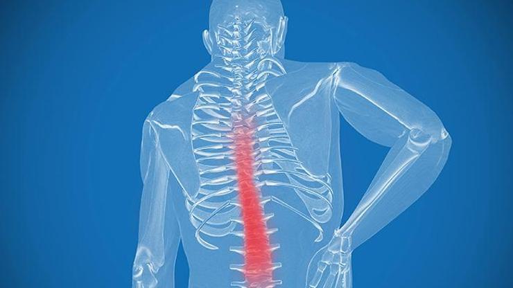 Parapleji Nedir Hemipleji Ve Tetrapleji Nedir Tedavileri Nasıl Yapılır